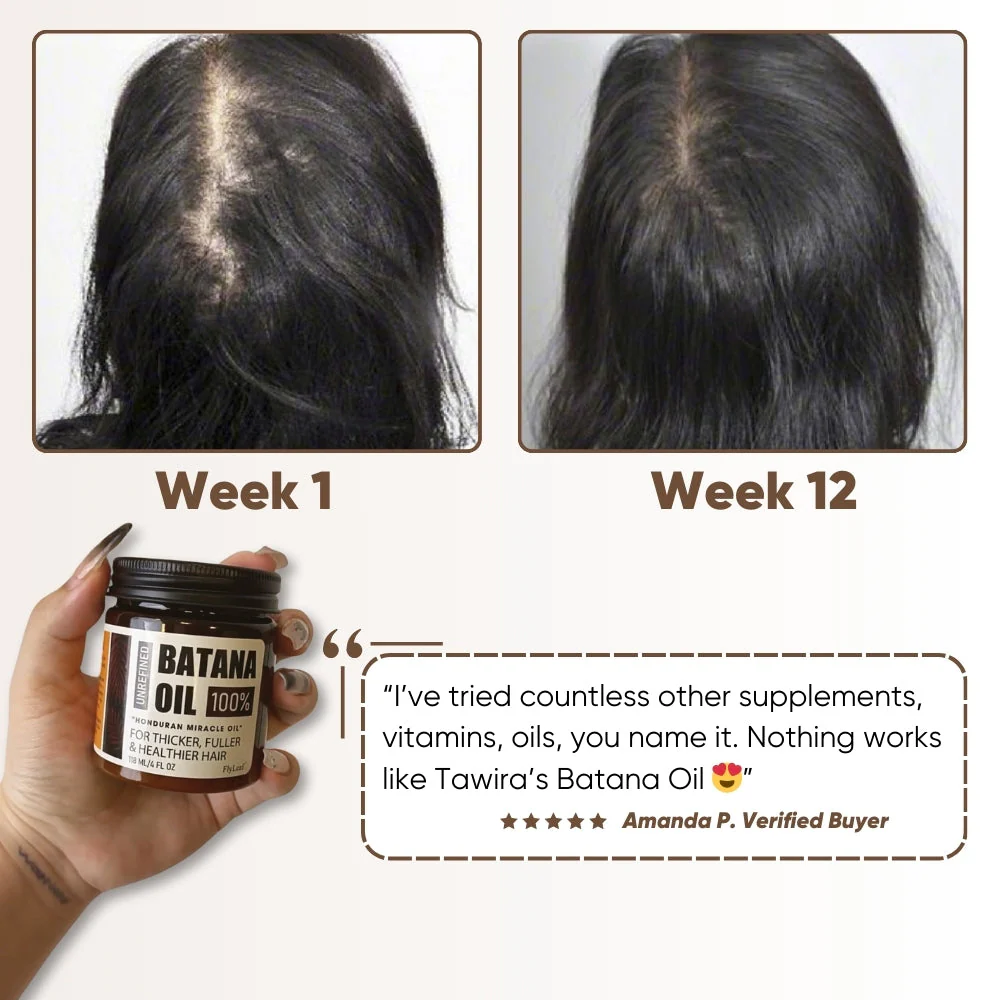 Batana Oil ~ Naturally thicker, healthier hair in just weeks - Image 3