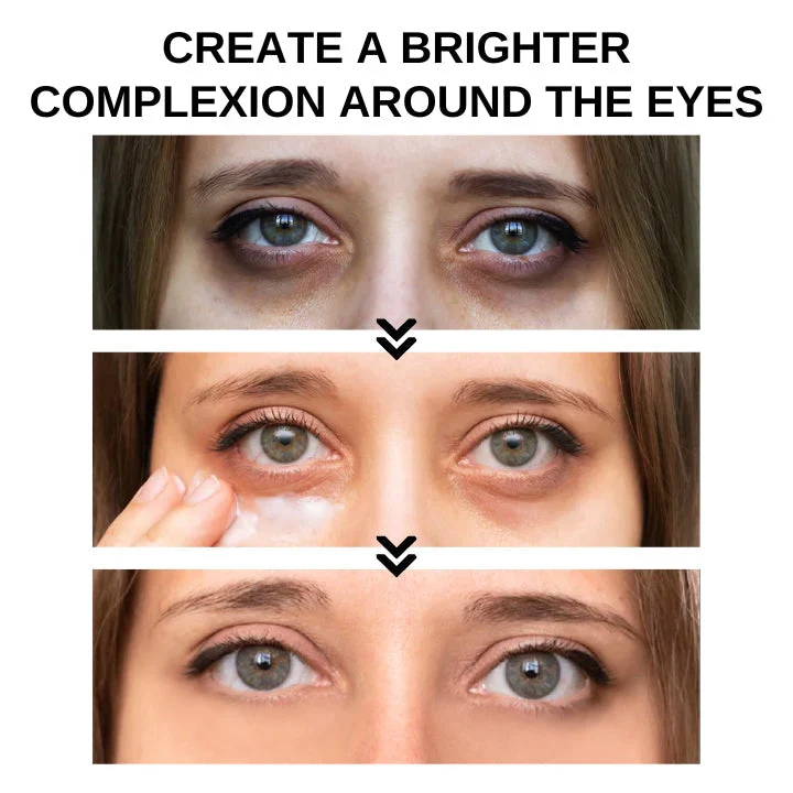 Instant Eye Tightener ~ Erase wrinkles and refresh eyes instantly~ - Image 4