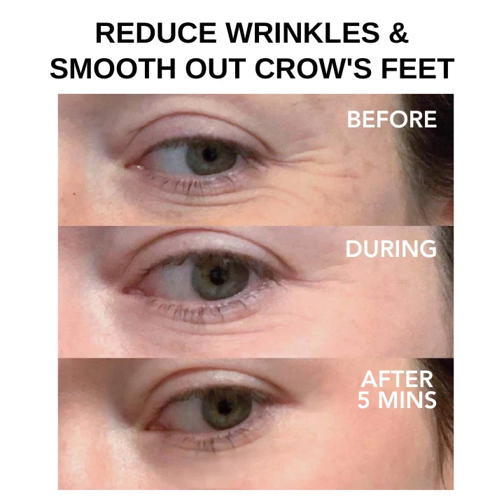 Instant Eye Tightener ~ Erase wrinkles and refresh eyes instantly~ - Image 6