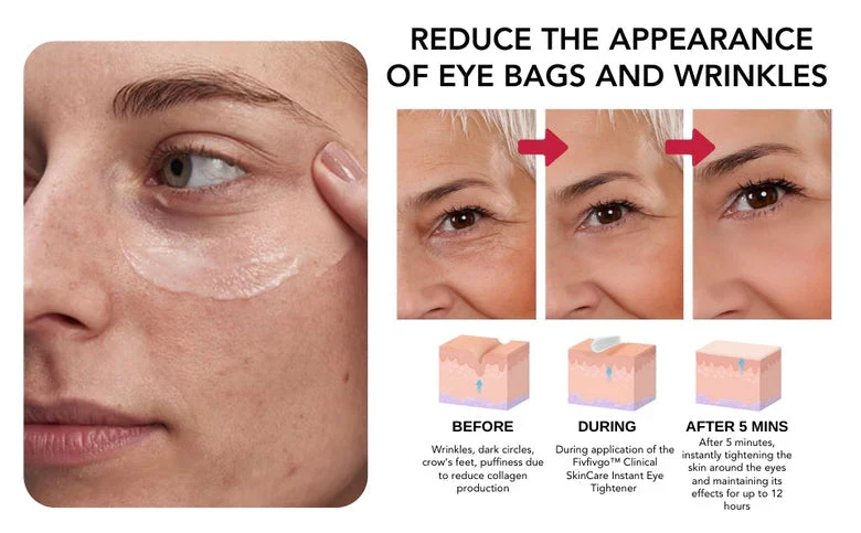 Instant Eye Tightener ~ Erase wrinkles and refresh eyes instantly~ - Image 8