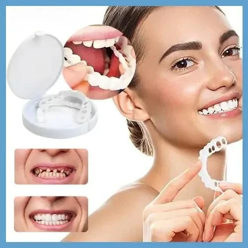 Snap-on veneers (Upper & Lower Set) ~ Instantly transform your smile with ease - Image 2