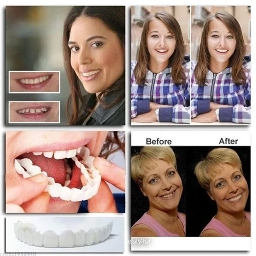 Snap-on veneers (Upper & Lower Set) ~ Instantly transform your smile with ease - Image 3