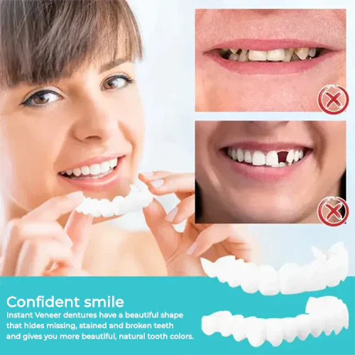 Snap-on veneers (Upper & Lower Set) ~ Instantly transform your smile with ease - Image 4